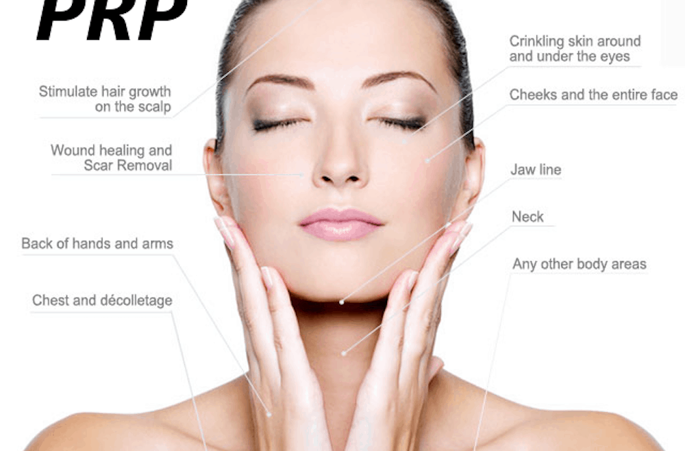 PRP-for-Facial-Rejuvenation-640W-1000x658[1]