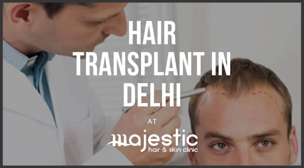 Hair Transplant in Delhi, Procedure & Cost - Majestic Derma