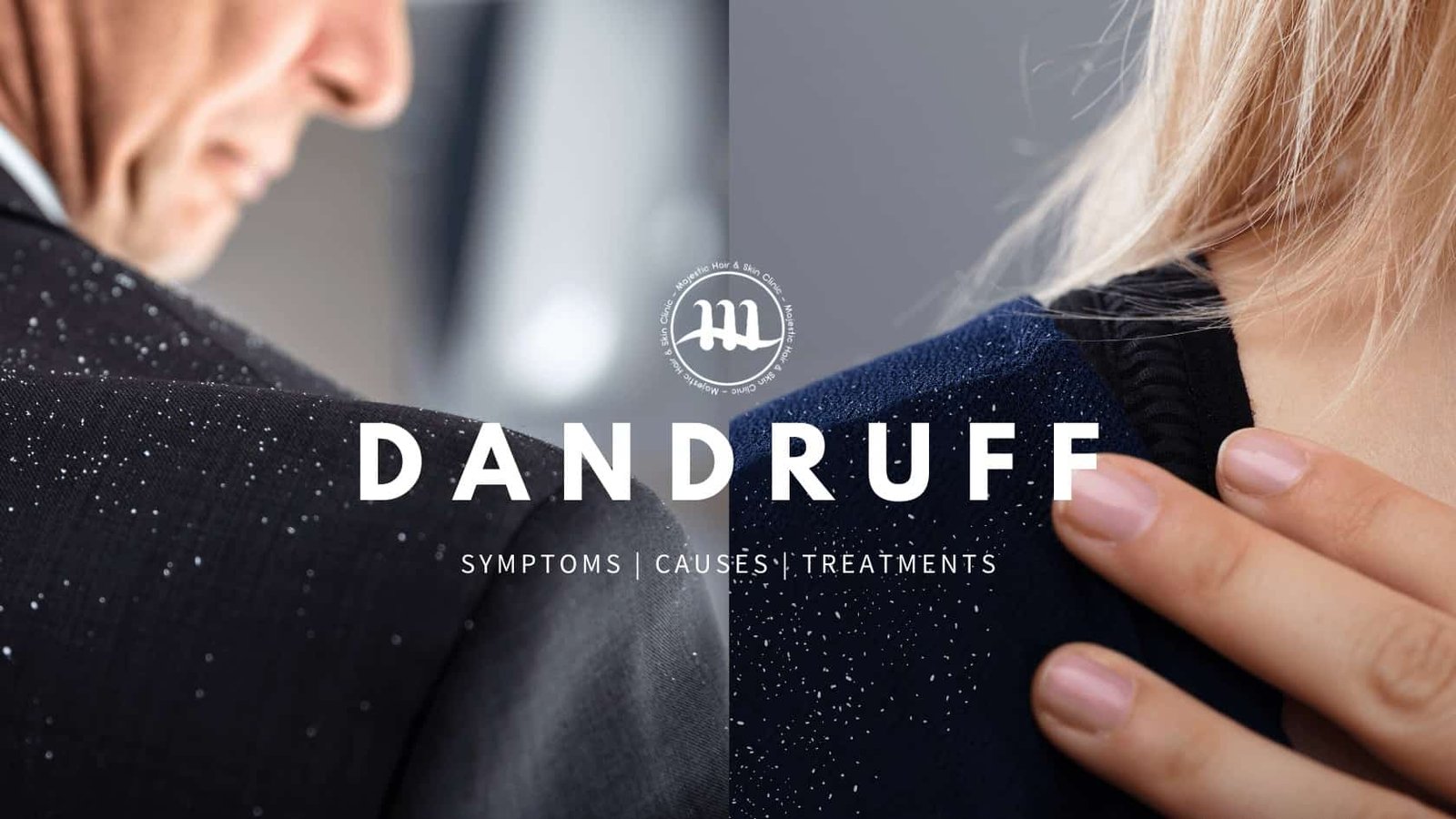 How to get rid of dandruff