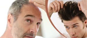 low level laser therapy hair loss before after