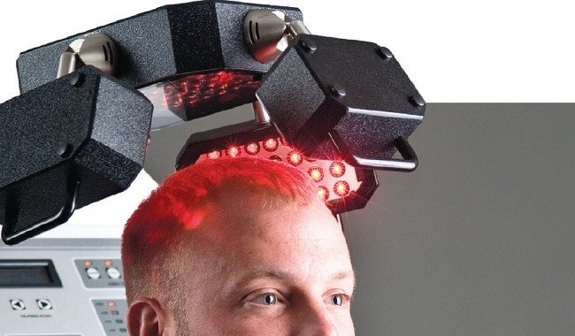 laser light therapy for hair loss