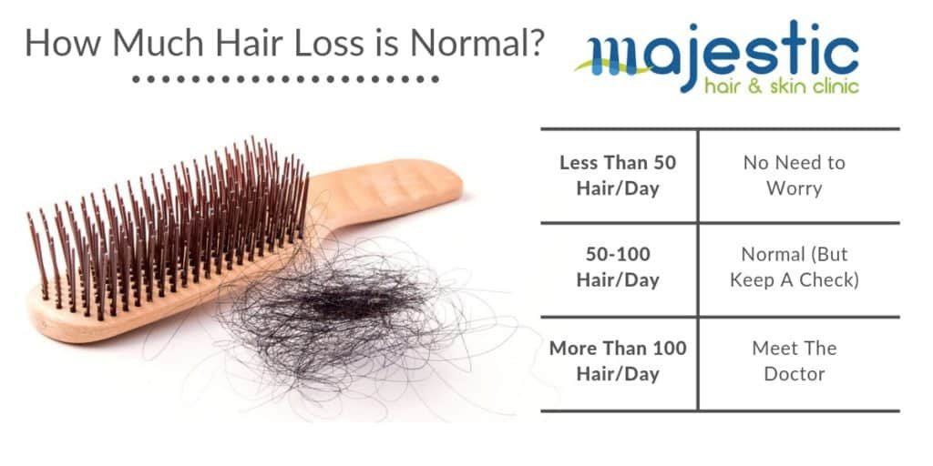 How Much Hair Loss is Acceptable - Majestic Derma