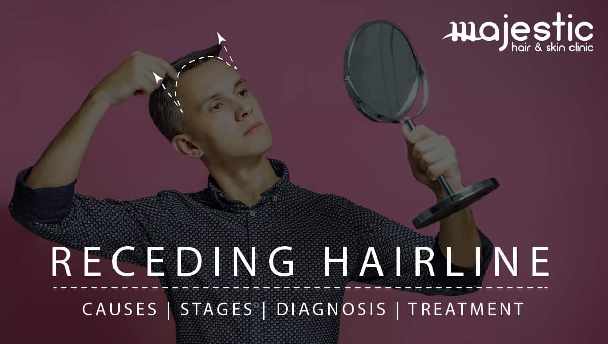 Read more about the article Receding Hairline: Causes, Stages, Diagnosis and The Best Ways To Treat