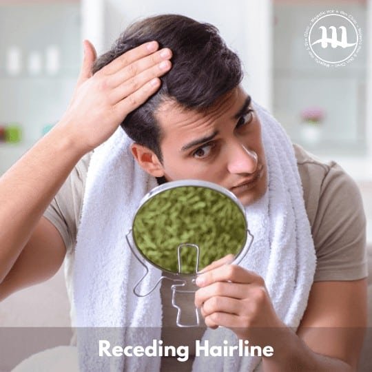 Receding Hairline - Majestic Hair And Skin Clinic