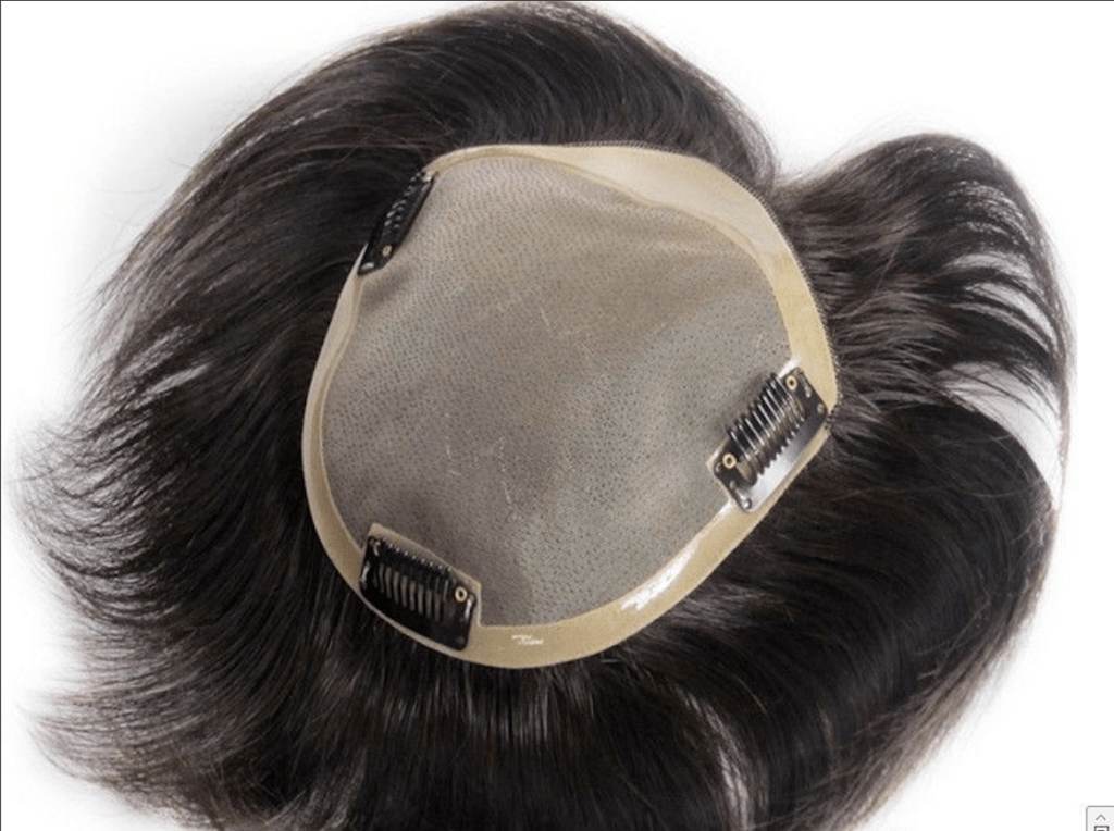 Hair Patch In Delhi Process Cost Success Rate Time Results