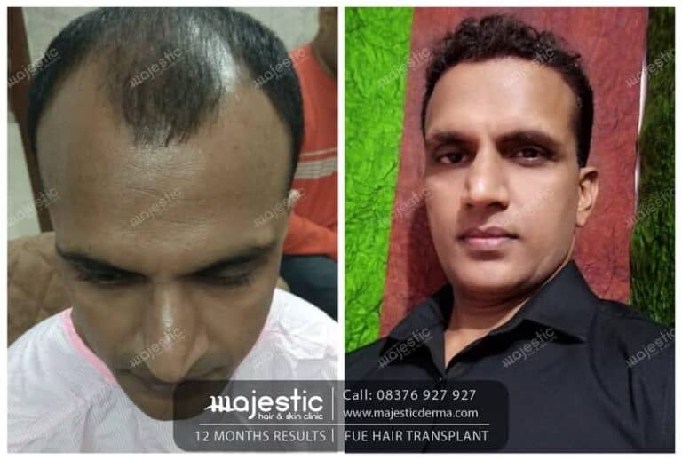 Majestic Hair And Skin Clinic - It's incredible seeing the different looks  and the confidence in our client's life. This before and after is just a  glance to show how Majestic Adv
