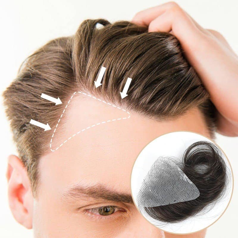 Read more about the article How a Custom Hair Patch Can Restore Confidence & Natural Appearance