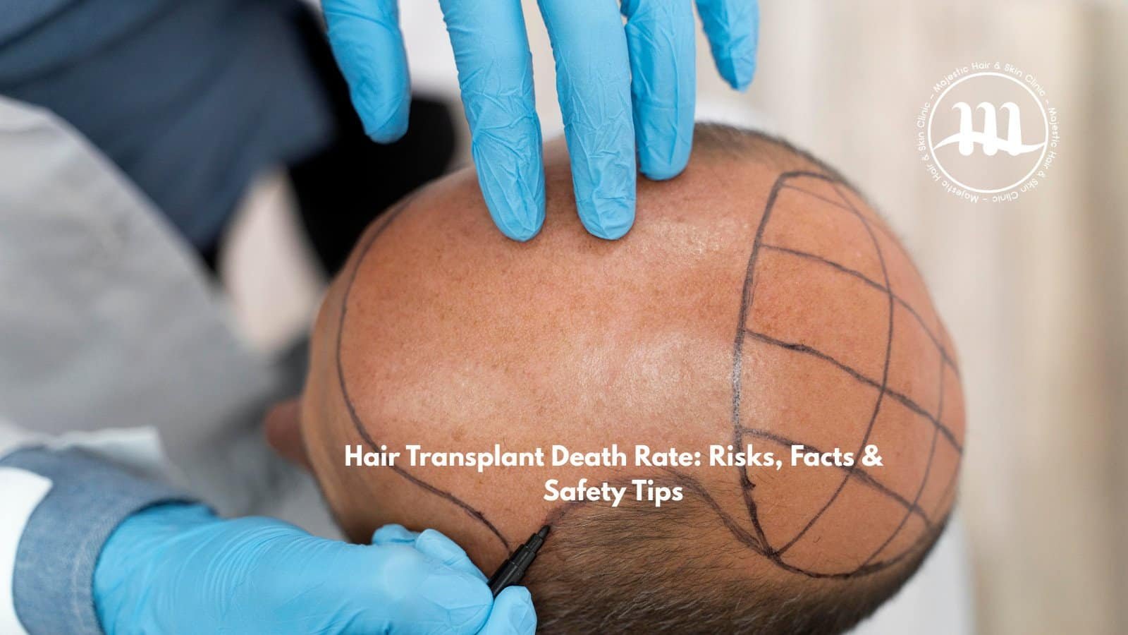 Hair Transplant Death Rate