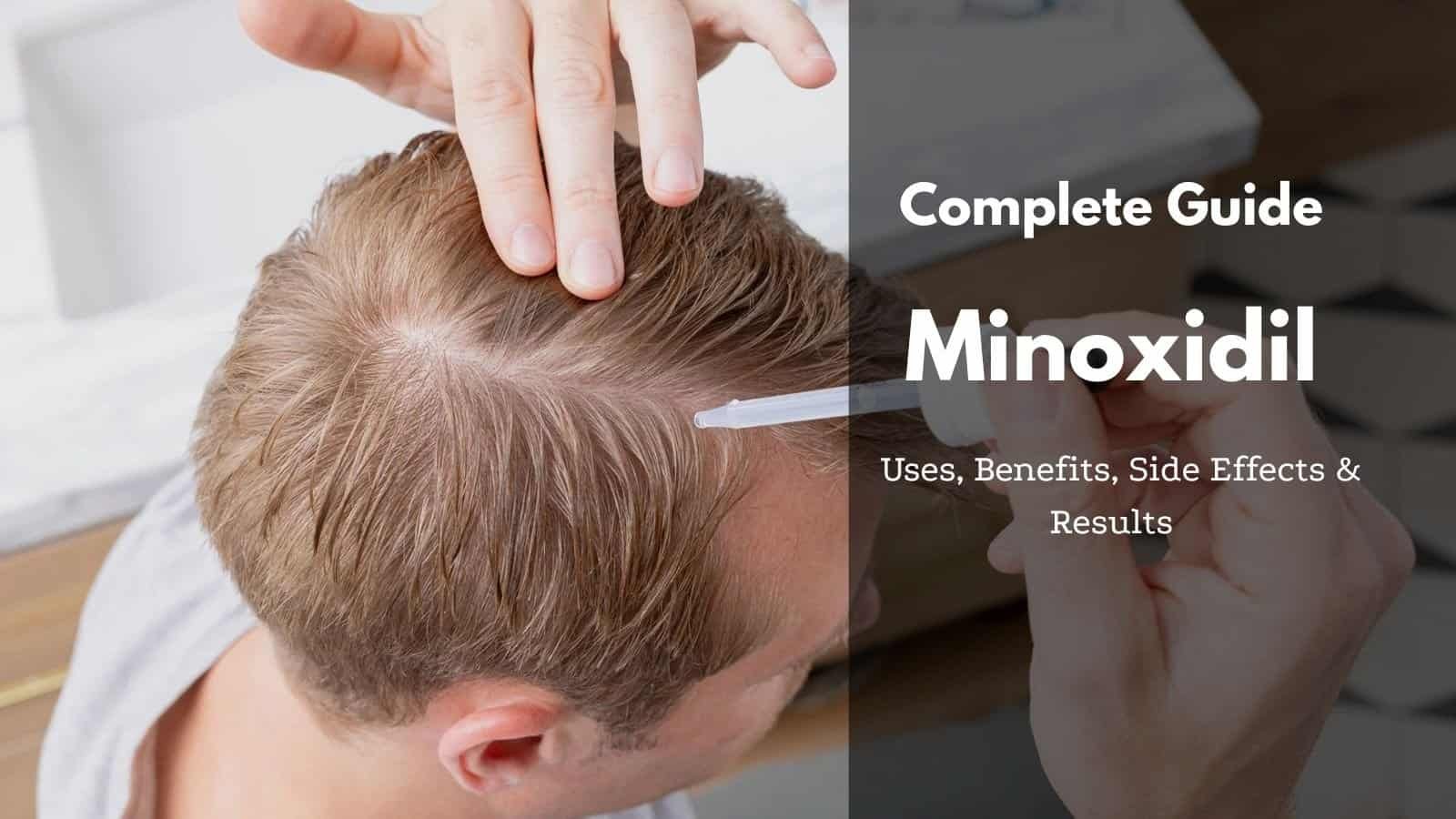 Minoxidil Complete Guide: Uses, Benefits, Side Effects & Results