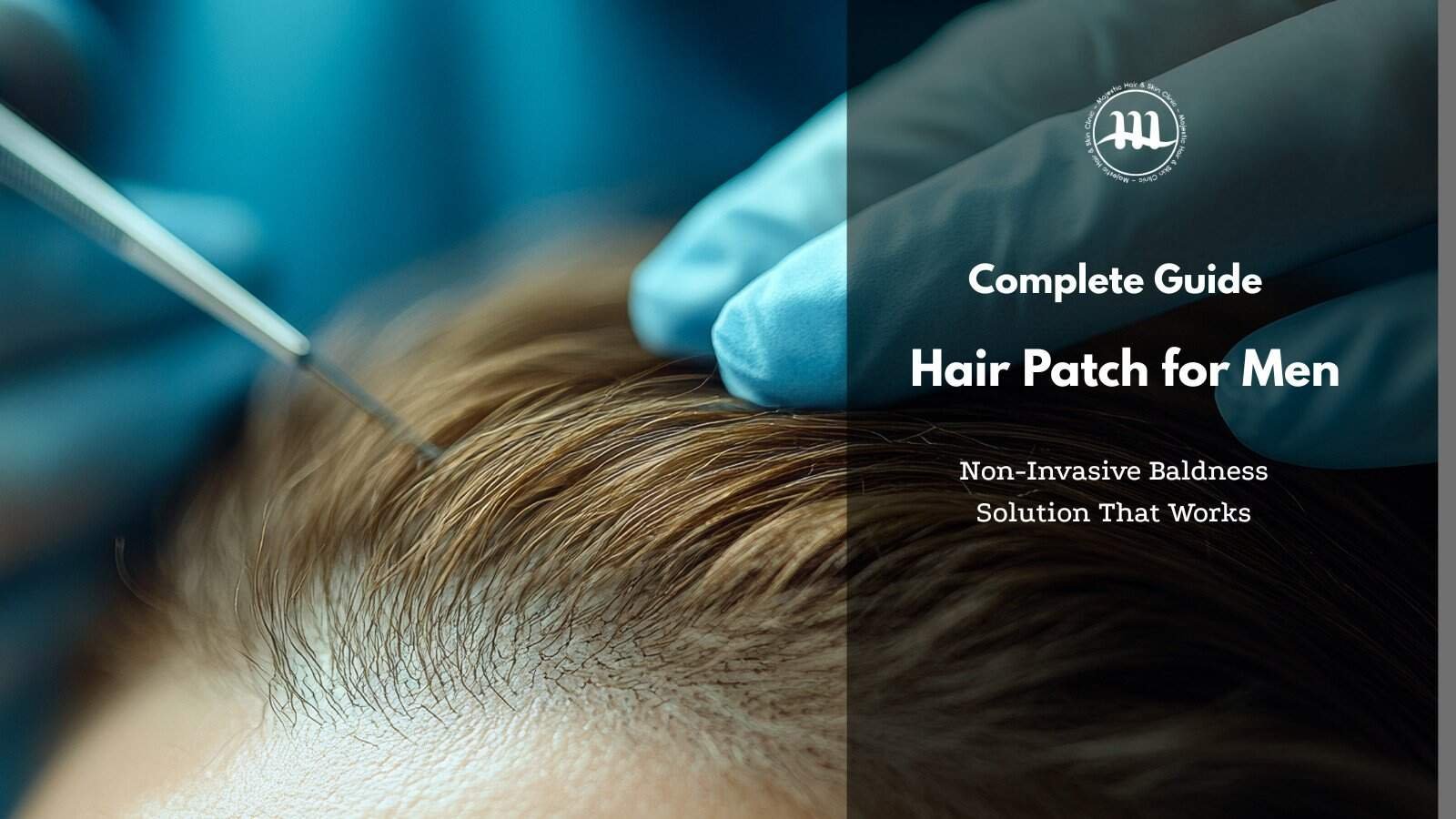 Hair Patch for Men: Non-Invasive Baldness Solution That Works