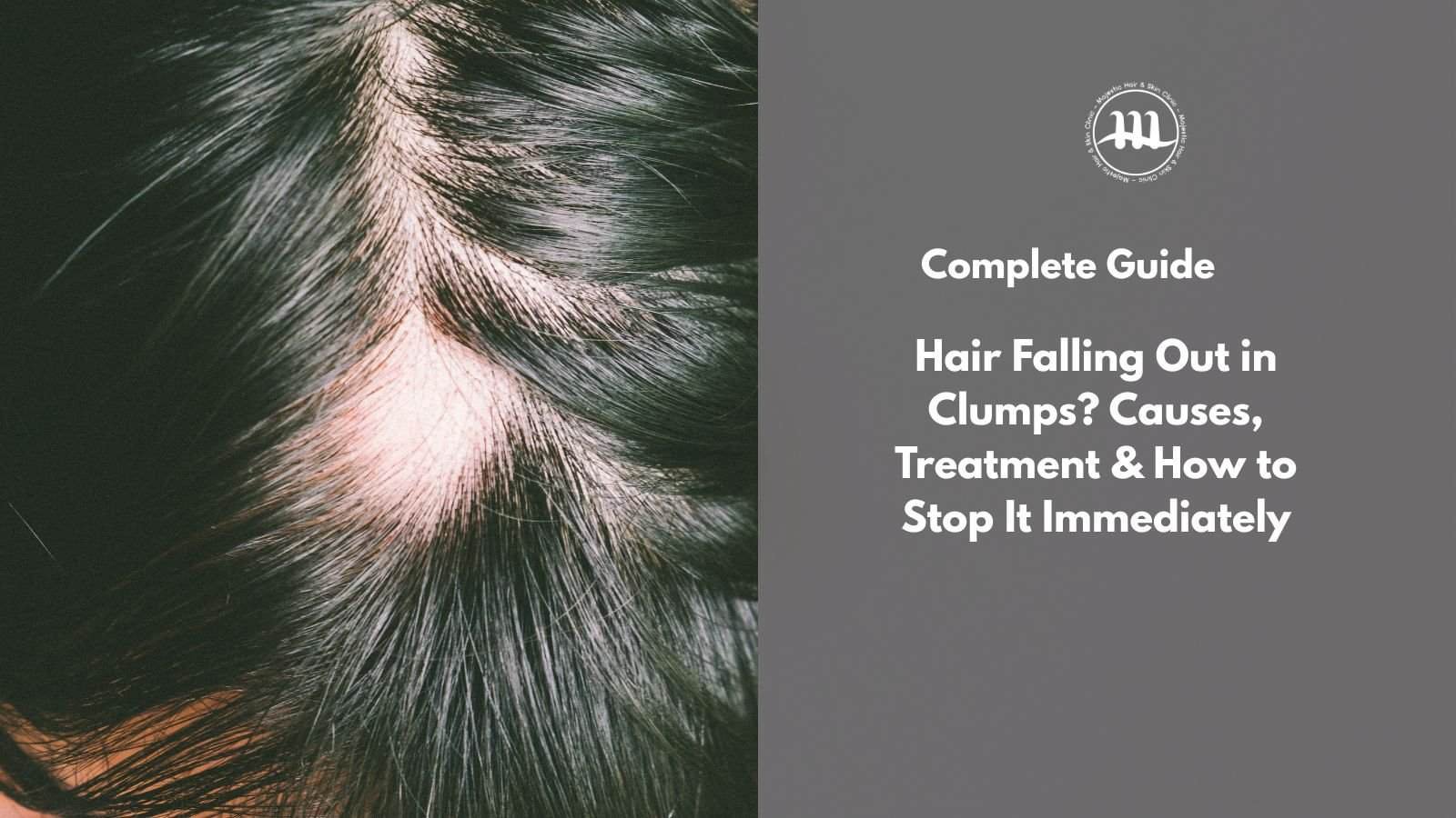 Hair Falling Out in Clumps? Causes, Treatment & How to Stop It Immediately