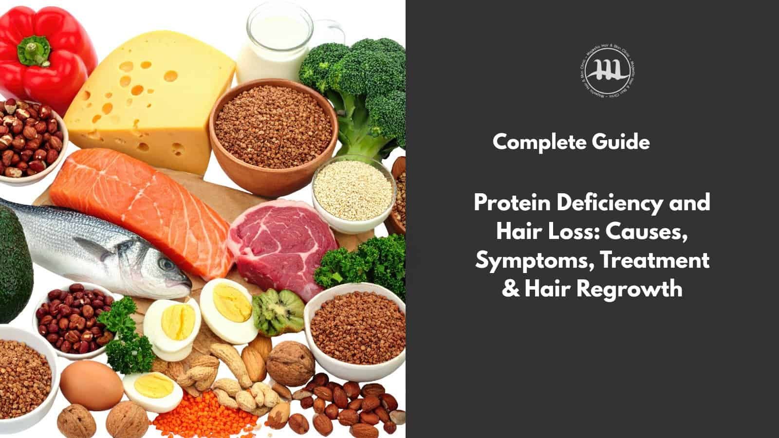 Protein Deficiency and Hair Loss: Causes, Symptoms, Treatment & Hair Regrowth