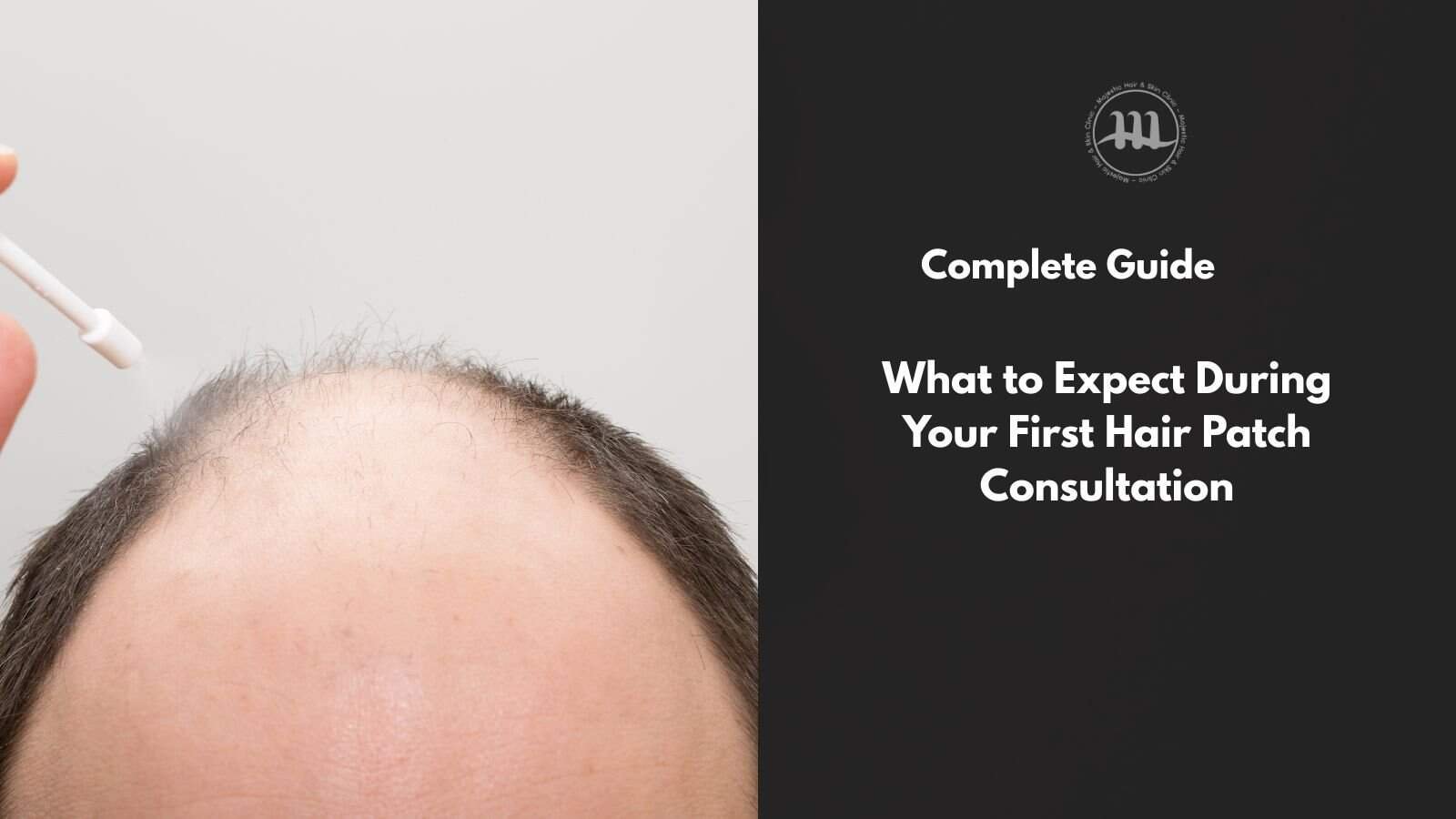 What to Expect During Your First Hair Patch Consultation